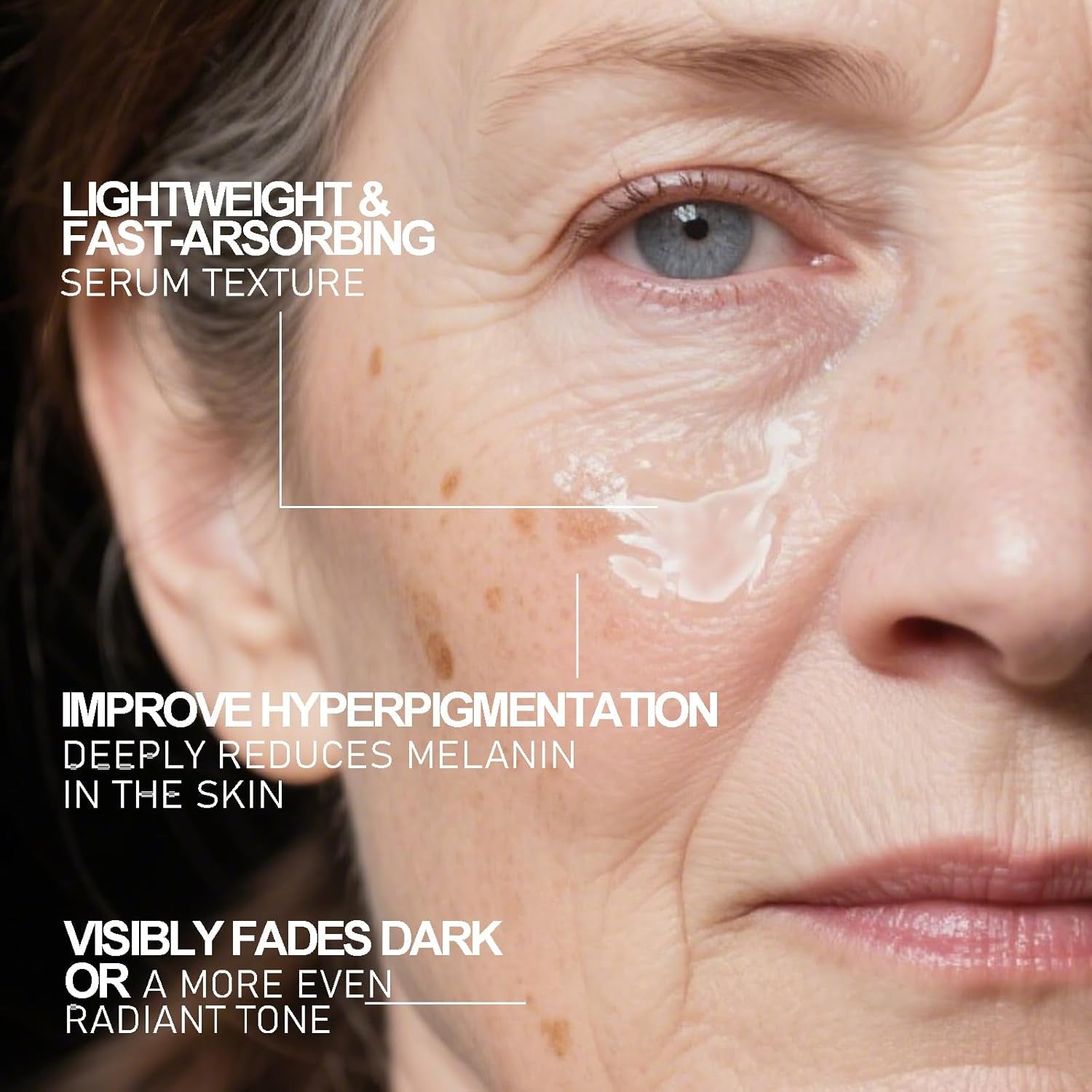 Aobenz Dark Spot Remover for Face & Body