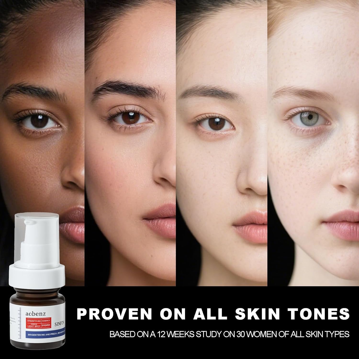 Aobenz Dark Spot Remover for Face & Body