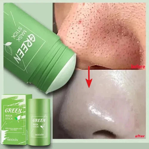 Green Mask - Acne & Pore Care