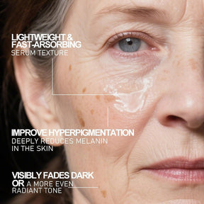 Aobenz Dark Spot Remover for Face & Body