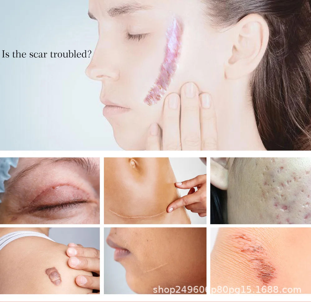 Yoxier Lavender Scar & Stretch Mark Repair Cream