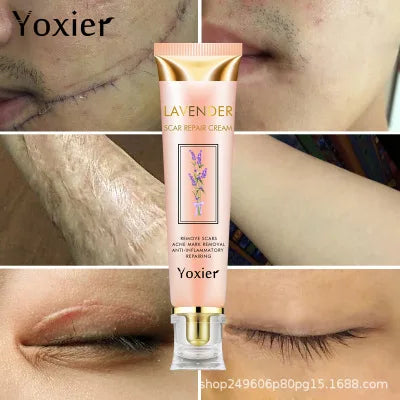 Yoxier Lavender Scar & Stretch Mark Repair Cream
