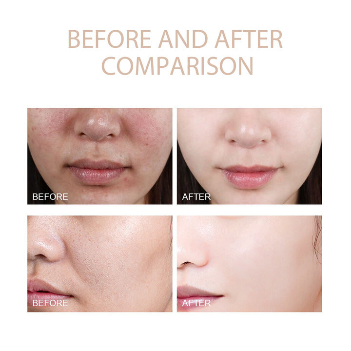 Exfoliating Gel