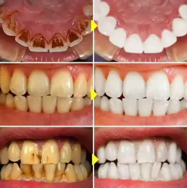 Teeth Whitening Essence Pen