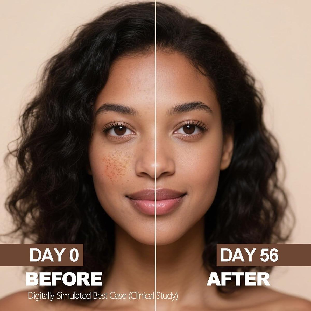 Aobenz Dark Spot Remover for Face & Body