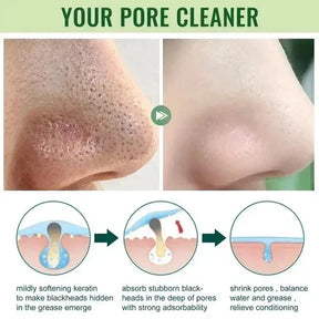 Green Mask - Acne & Pore Care
